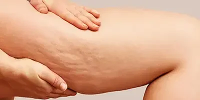 riabilitazione dermatofunzionale​